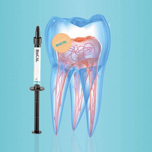 BisiCal – La solution idéale pour la protection pulpaire