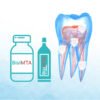 BisiMTA – Ciment de réparation MTA biocompatible pour endodontie