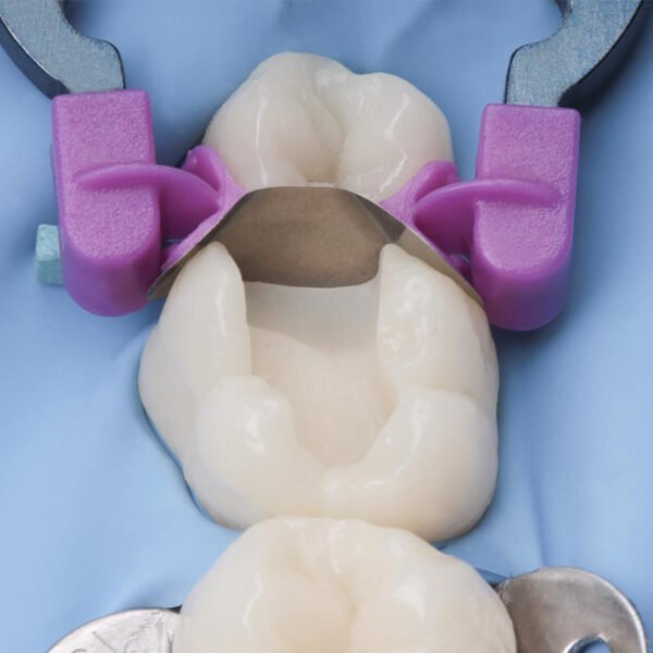 myQuickmat Forte Starter Kit