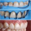 Unica Master Kit