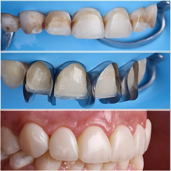 Unica Master Kit